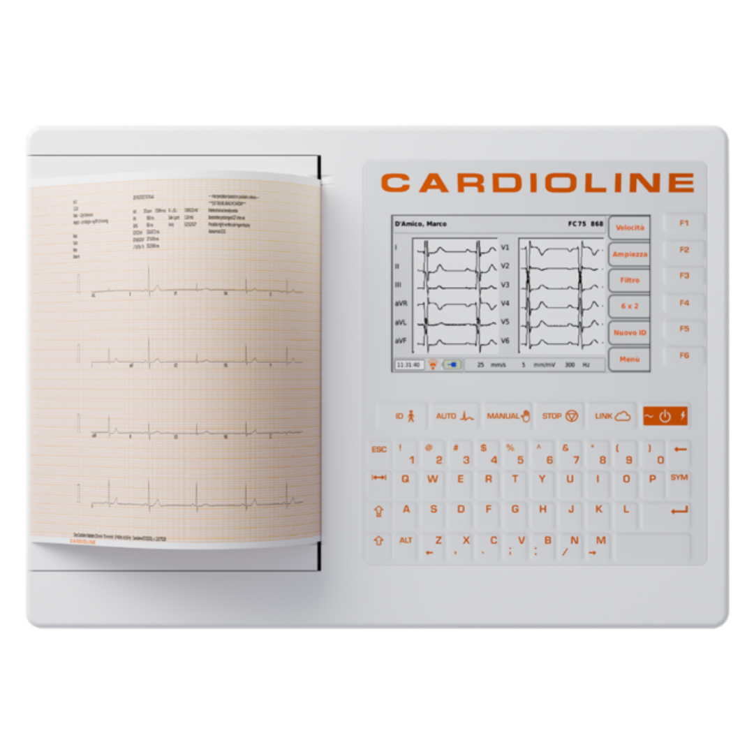 ECG200+